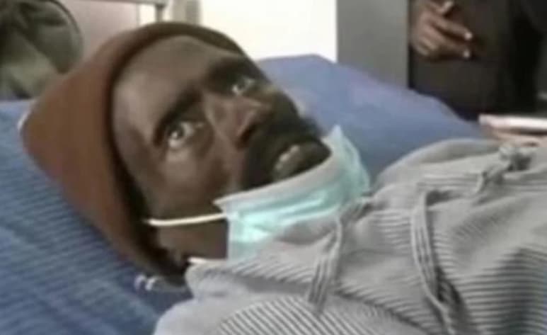 Mientras era preparado por los empleados de la morgue, el hombre despertó gritando al recuperar la consciencia después de haber sufrido un colapso (ESPECIAL)