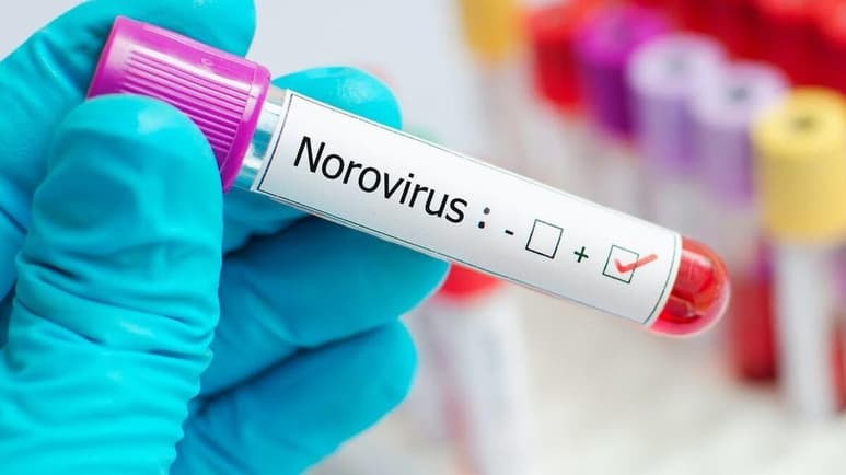 Las principales afectaciones pro Norovirus son gastrointestinales (CAPTURA)