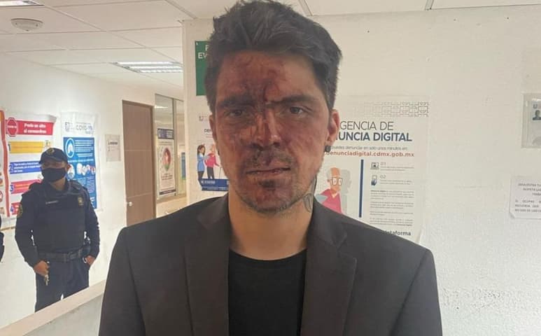 César, hijo menor de Lupita D'Alessio denunció que fue brutalmente golpeado en la casa del exgobernador del Estado de México, Arturo Montiel. (FACEBOOK)