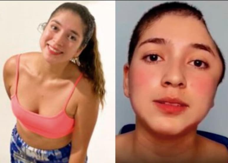 Paula Ágredo, una joven colombiana de 25 años de edad se convirtió en influencer en poco menos de dos semanas luego de compartir su historia tras sufrir un aparatoso accidente en bicicleta. (Especial)