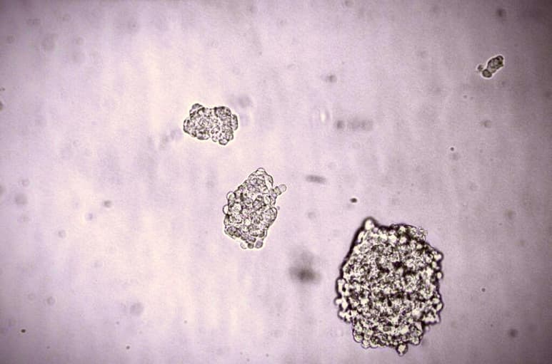 El Instituto de Biología Molecular de Barcelona (IBMB-CSIC) y la Universidad Johannes-Gutenberg de Mainz (Alemania) han descubierto un mecanismo celular esencial en la señalización celular, cuya disfunción podría contribuir a desarrollar enfermedades neurodegenerativas como el alzhéimer, así como fibrosis, nefritis o cáncer. (ESPECIAL)