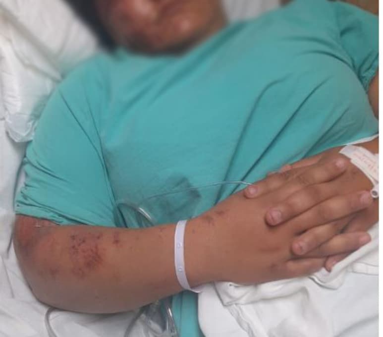 De acuerdo con la declaración de la joven, había ingerido una pastilla de Diazepam. (EL SIGLO DE TORREÓN)