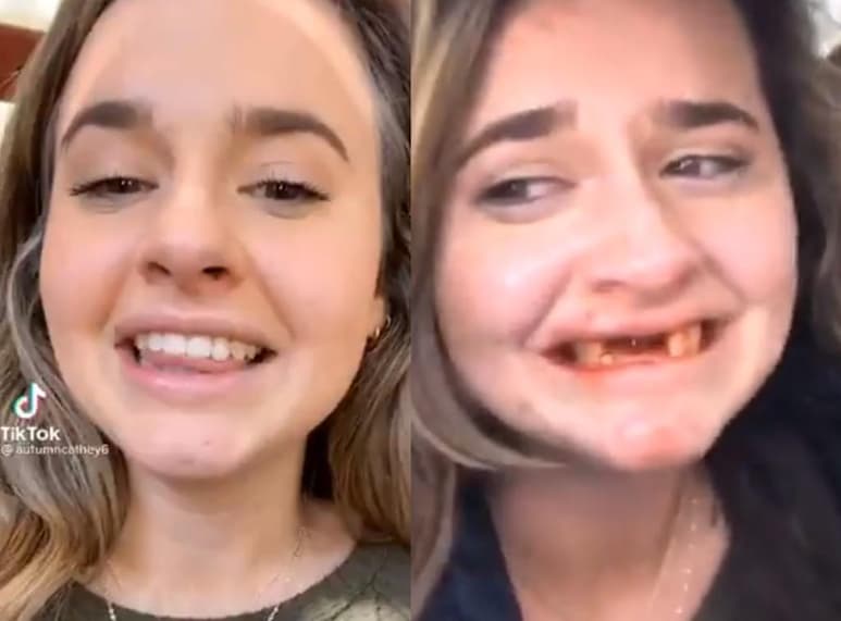 La mujer habría sufrido un accidente al encontrarse alcoholizada mientras intentaba grabar un video para TikTok junto a un amigo (CAPTURA)