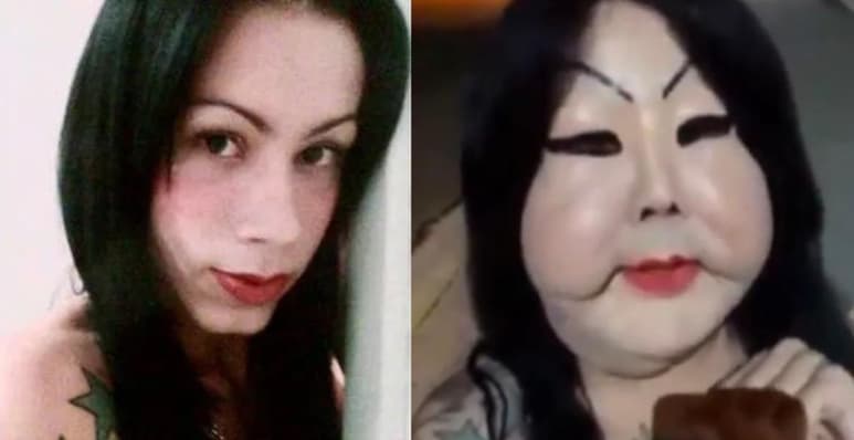La mujer trans dijo que le inyectaron silicona industrial en una clínica clandestina en 2017 (REDES SOCIALES)