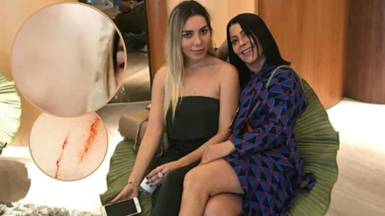 Una serie de fotografías y audios de Frida Sofía filtradas a través de redes sociales, comprobarían que sufrió agresiones por parte de su madre, Alejandra Guzmán. (ESPECIAL)