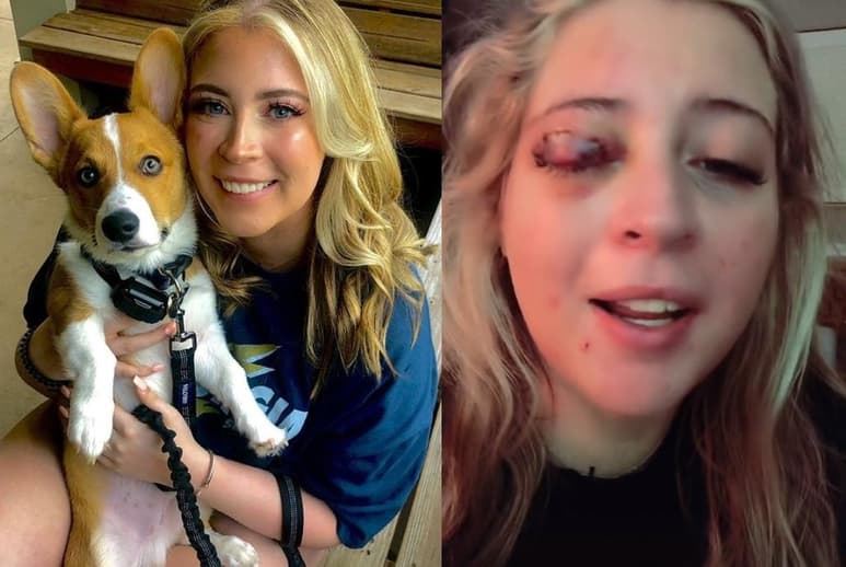 La mujer narró que tras terminar el tratamiento, el perro se le echó encima y mordió su ojo (CAPTURA)