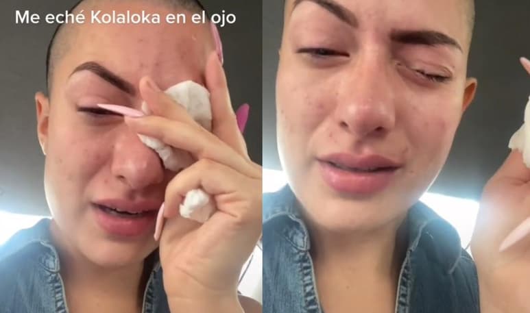A través de TikTok, la mujer mostró su ojo supuestamente pegado tras confundir sus gotas con una botella de pegamento (CAPTURA)