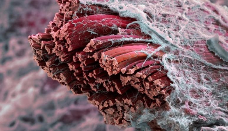 ¿Ropa hecha con fibras musculares? Un equipo científico ha logrado crear músculo sintético en el laboratorio, más resistentes que el algodón, la seda, el nailon o incluso el kevlar (material usado en chalecos antibalas), y que está desarrollado a partir del uso y manipulación de microbios. (ESPECIAL)