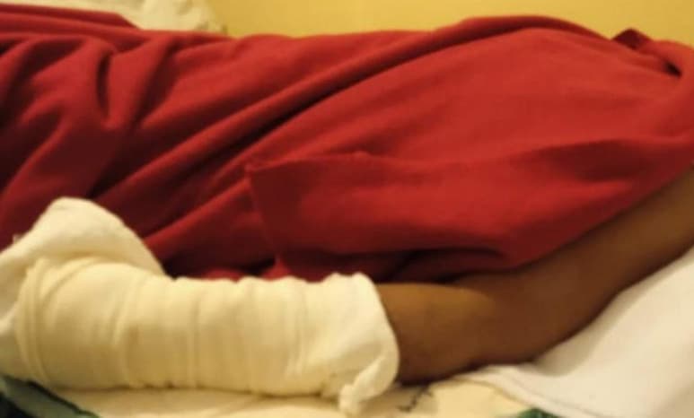 Olivia Ibarra Sánchez, mujer a la que un hombre le prendió fuego en el rostro y las extremidades al defender a una adulta mayor que era golpeada, dice que teme por su integridad. Además, debe enfrentar la falta de recursos para comprar los medicamentos que le recetaron para seguir con su tratamiento. (ESPECIAL)