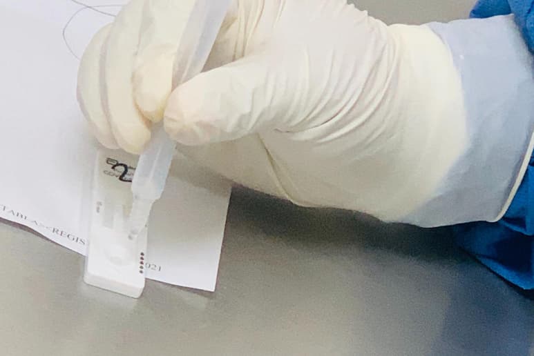 Las pruebas rápidas de detección de antígeno se realizan en las diferentes instituciones de salud del estado de Coahuila.