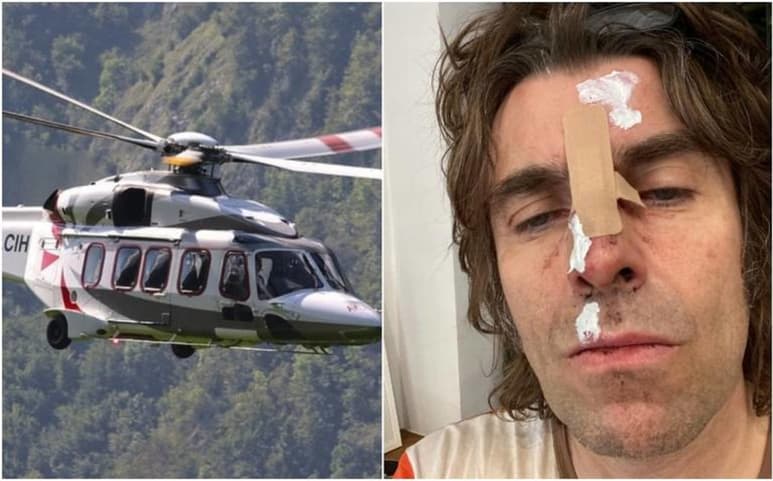 El que fue vocalista de Oasis y uno de sus fundadores, Liam Gallagher, compartió en redes sociales una imagen suya con heridas y cortes en la cara tras 'caer de un helicóptero' este fin de semana. (ESPECIAL)