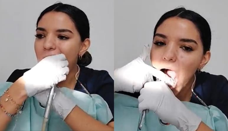 La dentista mostró a través de Twitter el proceso que ella misma se tuvo que aplicar para extraerse las muelas del juicio (CAPTURA)