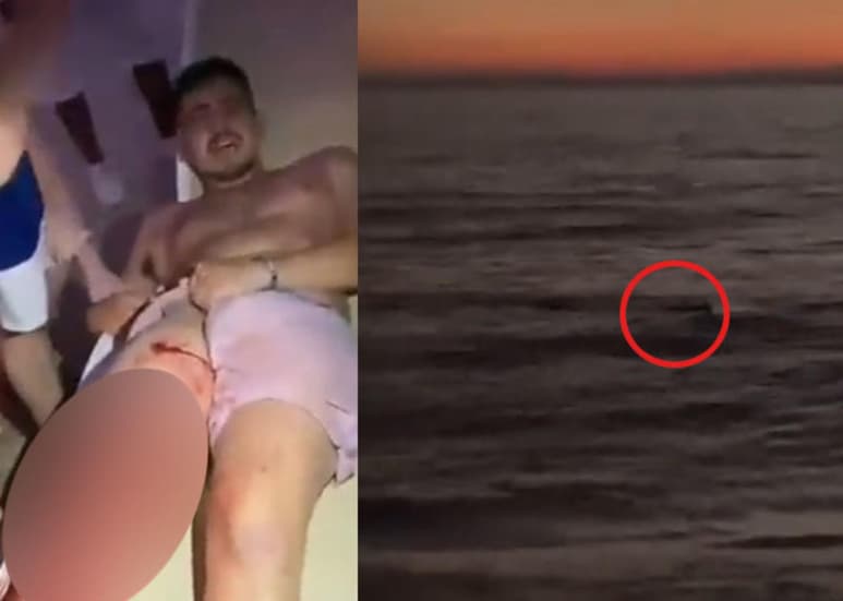 Mientras nadaba en playas de Nuevo Vallarta, el turista proveniente de Texas, fue mordido por el cocodrilo en una de sus piernas (CAPTURA)