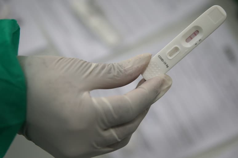 No se tienen casos confirmados, ni internados en los hospitales privados.