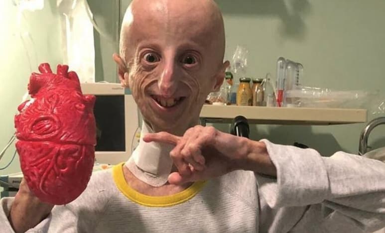 Sammy Basso tiene el Síndrome de Progeria Hutchinson-Gilford. (Foto: Facebook / Sammy Basso)