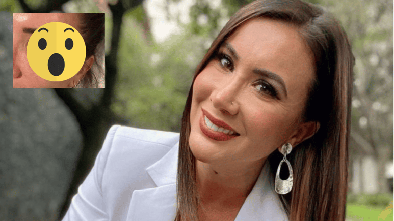 ¿Qué le pasó? Mariazel provoca la alarma en sus seguidores tras aparecer con el ojo morado