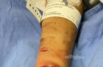 Sofia fue arrollada generando heridas de gravedad. (EL SIGLO DE TORREÓN)