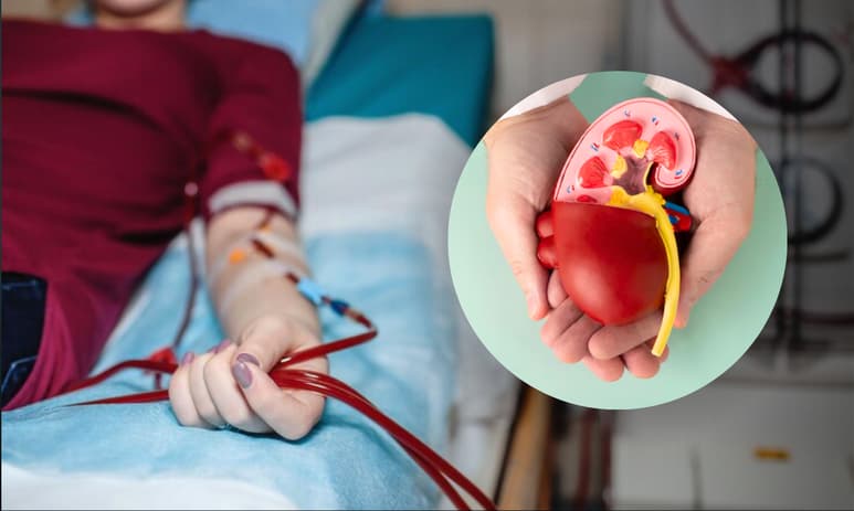 ¿Qué es la hemodiálisis y cuándo es necesaria?