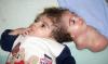 La niña egipcia Manar Magdi, de 11 meses de vida, fotografiada en la unidad de cuidados intensivos del hospital de Banha, a 45 kilómetros de el Cairo (Egipto) captada en febrero de 2005.


La niña fue separada de su mellizo tras una operación quirúrgica que duró doce horas.