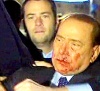 Con la boca ensangrentada, Berlusconi fue sacado inmediatamente en un coche oficial del lugar en el que se celebró un mitin de su partido y fue trasladado al hospital San Raffaele de la capital lombarda.