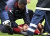 El incidente se produjo menos de un mes después que el volante de Bolton, Fabrice Muamba, sufrió un infarto durante un partido contra Tottenham por la Copa de la FA.