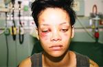 Uno de los casos más sonados de violencia fue el que protagonizó Rihanna en 2009, al ser golpeada por su entonces pareja, Chris Brown.
