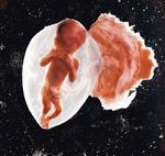 Aparece además la foto de un feto aún en el útero de Lennart Nilsson.