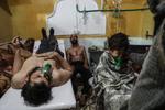 Fotografía publicada como parte de la historia 'Syria, No Exit' que muestra una habitación de un hospital con varias personas afectadas por un ataque con gas tóxico, perpetrado el 25 de febrero de 2018, en la localidad de Guta (Siria).