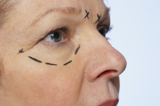 Aún no superan al Botox