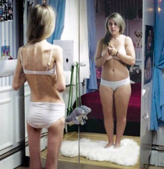 La anorexia y la bulimia provocan delgadez extrema,  debilidad,  caída del cabello,  huesos quebradizos,  amenorrea (o falta de menstruación),  mala piel,  sensación de frío,  daños a sistema digestivo y otros órganos. En última instancia,la muerte.