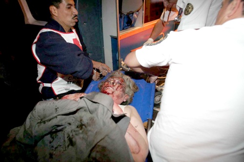Algunos de los heridos en el accidente de avión en el que murió el secretario de Gobernación, Juan Camilo Mouriño, fueron trasladados de la Cruz Roja de Polanco
al hospital Rubén Leñero.