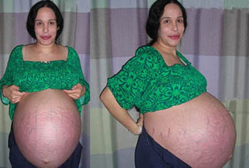 Suleman afirmó que tras siete años tratando de quedar embarazada acudió a la clínica de fertilización in vitro, donde se sometió a un programa de fertilidad con éxito. (Foto Especial)
