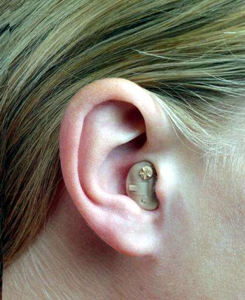 Las células madre utilizadas en la investigación fueron extraídas del caracol o cóclea aún en desarrollo procedente de fetos de entre 9 y 11 semanas de gestación.