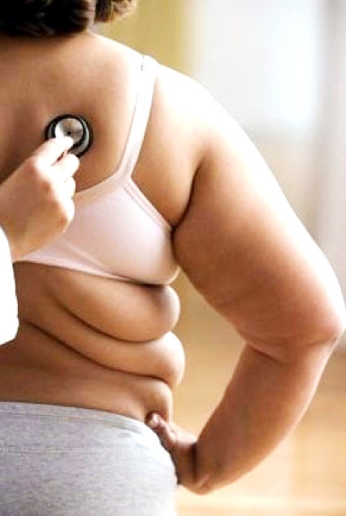 La obesidad se calcula en base al índice masa-peso, una ecuación en que se toma en cuenta el peso y la altura de una persona. Por ejemplo, una persona de 1.75 metros de altura (5 pies, 9 pulgadas) que pese 92 kilos (203 libras) tendrá un índice de 30, el mínimo antes de ser considerado obeso.