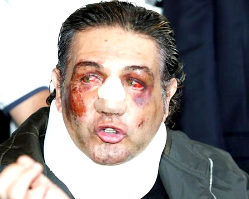 Trasladan al comunicador Fabián Lavalle a hospital, después de que lo encontraran golpeado y tirado en la calle.