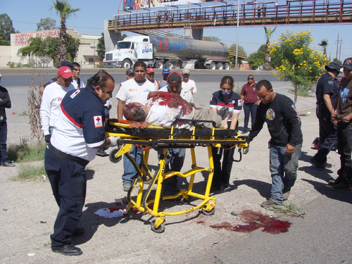 Herido. Por el choque en periférico, el motociclista perdió su casco.  EL SIGLO DE TORREÓN