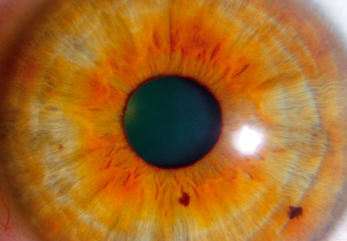 El iris, ¿espejo del cuerpo?
