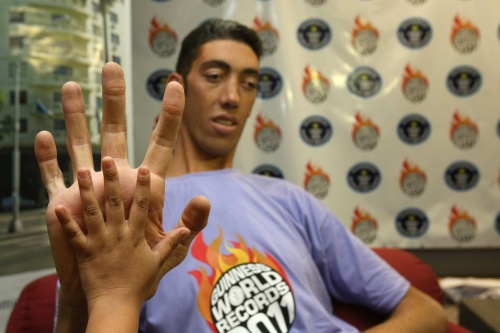 Hombre más alto del mundo no quiere crecer más