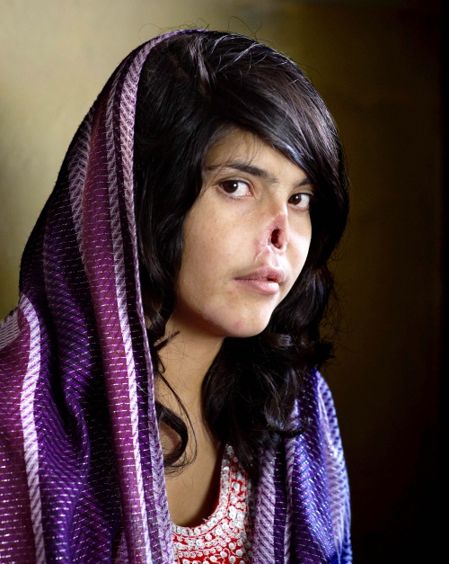La fotografía ganadora, que fue portada el pasado agosto de la revista 'Time', muestra cómo mira a cámara Bibi Aisha, de 18 años, a la que le fueron amputadas la nariz y las orejas por no obedecer a su marido. (EFE)