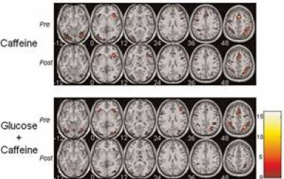Un estudio demostró que el cerebro puede ser más eficiente bajo los efectos de la cafeína y la glucosa tomadas simultáneamente.