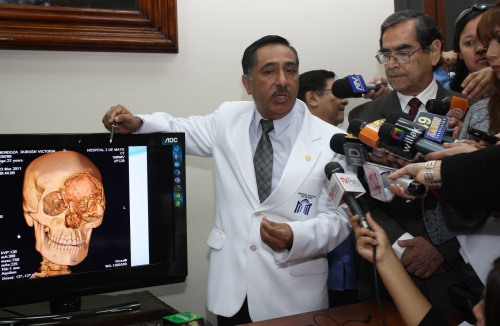 El director del hospital Dos de Mayo, José Fuentes Rivera, explica el procedimiento de la cirugía. EFE