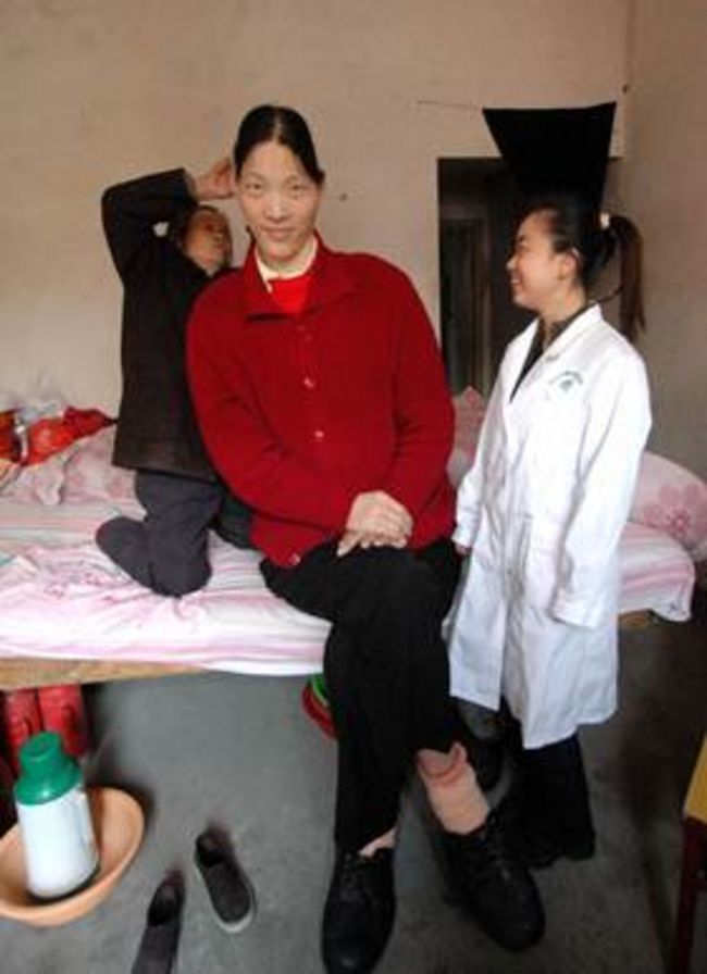 Muerte. Yao Defen era china y medía dos metros con 33 centímetros.