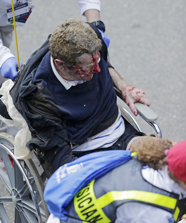 Heridas. Tras concluir el maratón un atleta es atendido por las heridas que sufrió.