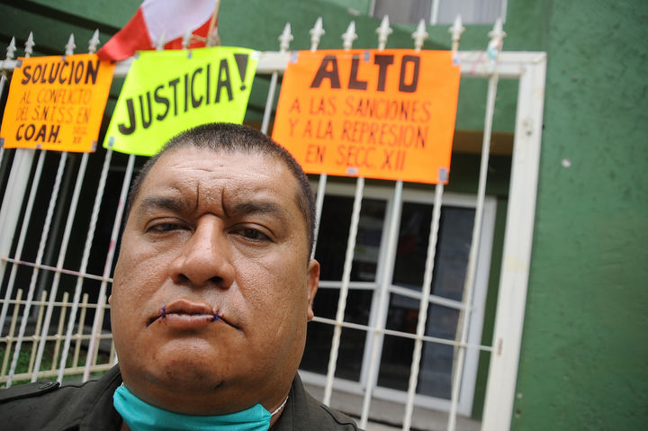 Protesta. Ayer Rubén López cosió sus labios para iniciar una huelga de hambre, exige solución a problemas sindicales en el IMSS.
