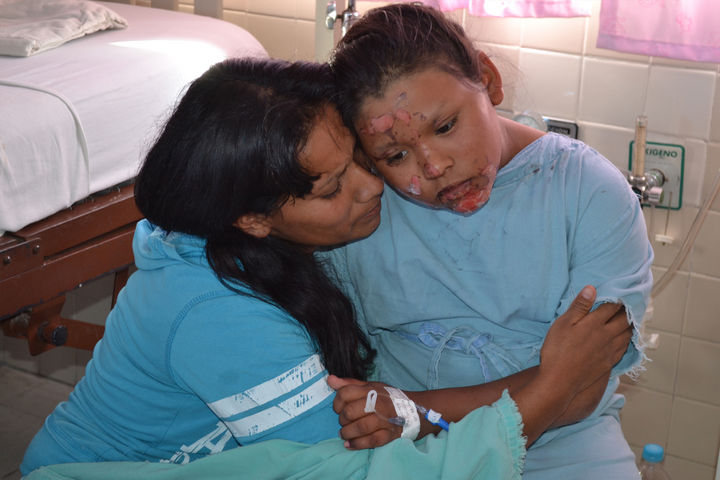 Necesitan apoyo. Perla Citlalli y su tía piden apoyo de la ciudadanía para solventar los gastos médicos recibidos por sus quemaduras.