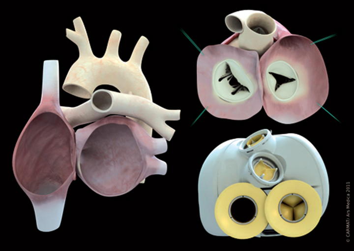 La sociedad, dedicada al desarrollo de prótesis médicas, fabricó a partir de tejidos biológicos un corazón totalmente artificial capaz de actuar de forma totalmente autónoma una vez trasplantado al paciente, una solución que podría resolver la escasez de donantes naturales. (EFE)