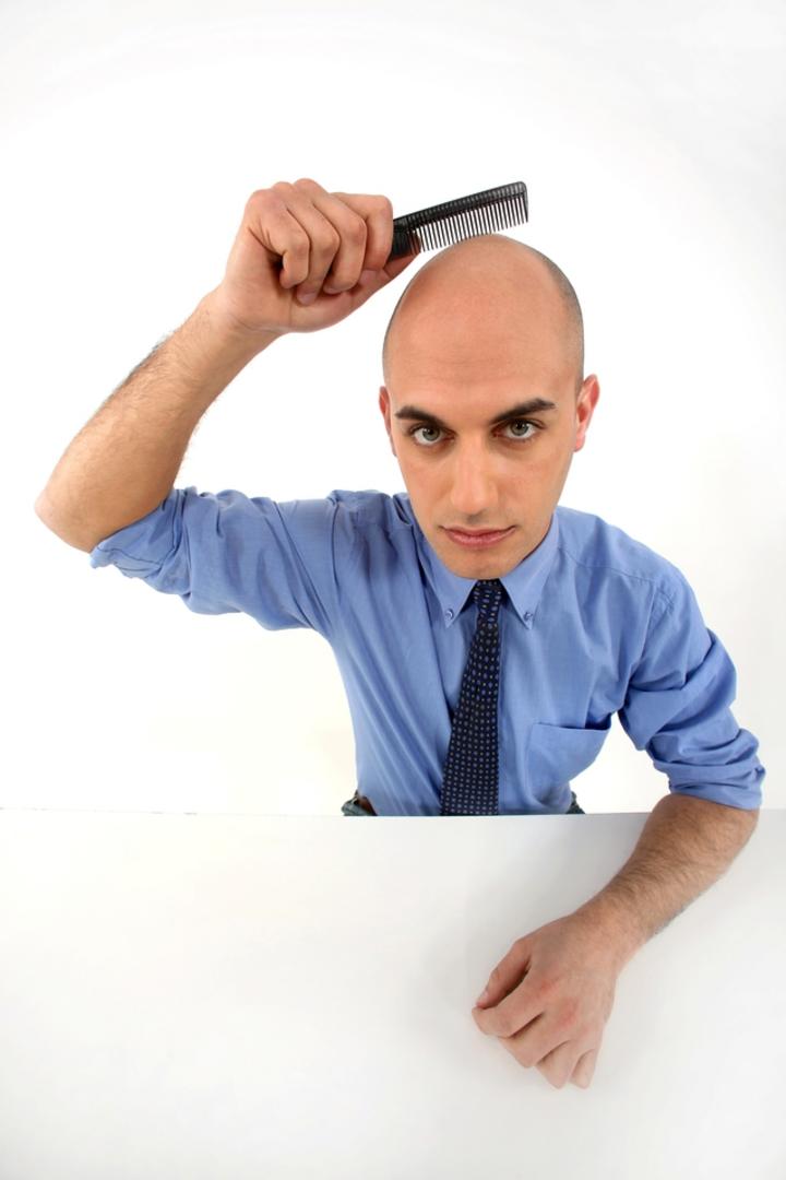 La calvicie masculina se presenta principalmente en la coronilla o en la zona frontal y entradas, se debe principalmente a la herencia y cuestiones hormonales, es conocida también como alopecia androgenética. (ARCHIVO)