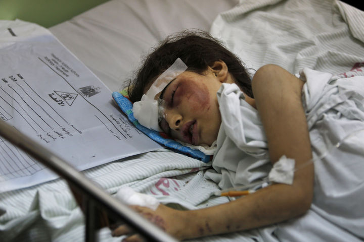 Enfrentamiento. Además de los muertos, se tienen numerosos heridos, como el caso de esta pequeña de siete años. (AP)