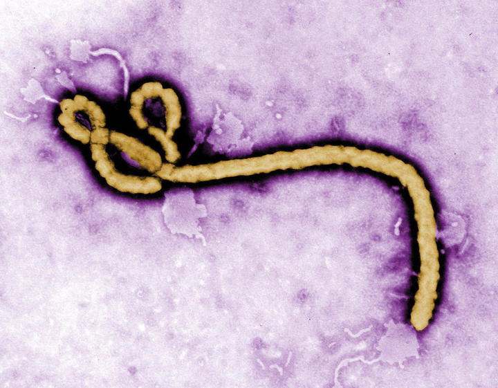 El virus, que también afecta a Sierra Leona, Liberia y Nigeria, ha contagiado hasta el momento a 3,069 personas, de las cuales 1,552 han fallecido, según el último recuento de la OMS. (ARCHIVO)