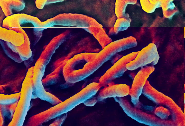 Hasta ahora, ningún caso de ébola ha sido confirmado en Estados Unidos. (Archivo) 